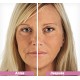 Rejuvenecedor Facial - Belsonic - Telemax Llame Ya!